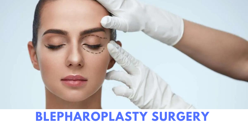 blepharoplasty cost in hyderabad