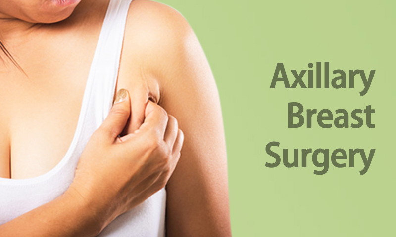 What is Axillary Breast Tissue