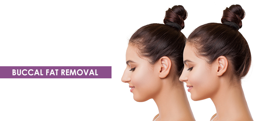 Cost of Buccal Fat Removal in Hyderabad