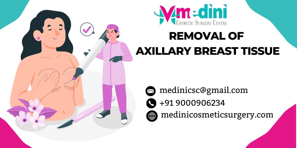 Removal of axillary breast tissue